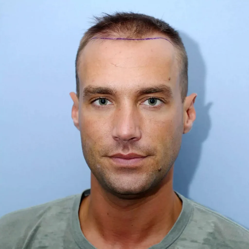 Calum Best